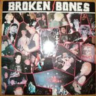 Broken Bones - Never Say Die (EP)