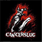 Cancerslug - Unnameable (Demo)