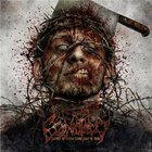 Craniotomy - Supply Of Flesh Came Just In Time