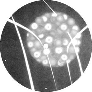 Recompiled / Extractions (Vinyl)