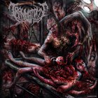Traumatomy - Beneficial Amputation Excess Limbs (EP)