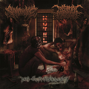 Dual Gimp Hysterectomy (Split)