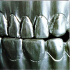 Change Of Heart - Steel Teeth