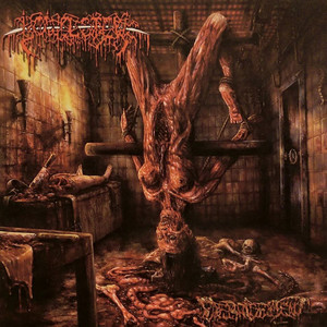 Debridement