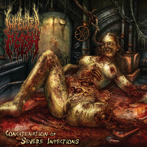 Concatenation Of Severe Infections