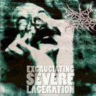 Excruciating Severe Laceration