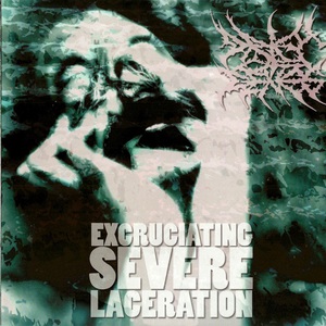 Excruciating Severe Laceration